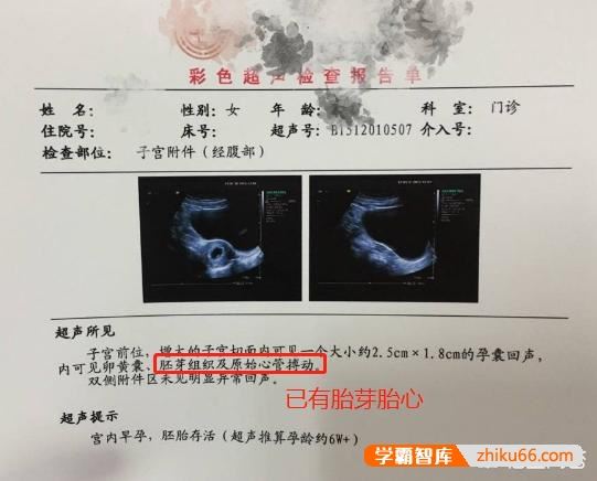 怀孕四十九天听不到胎心正常吗？